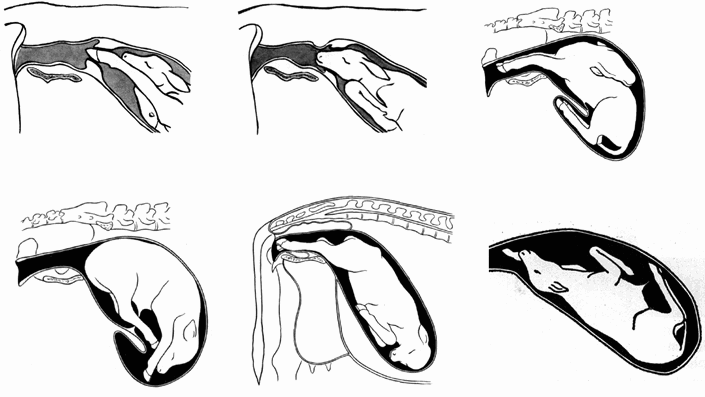 Abnormal Presentation