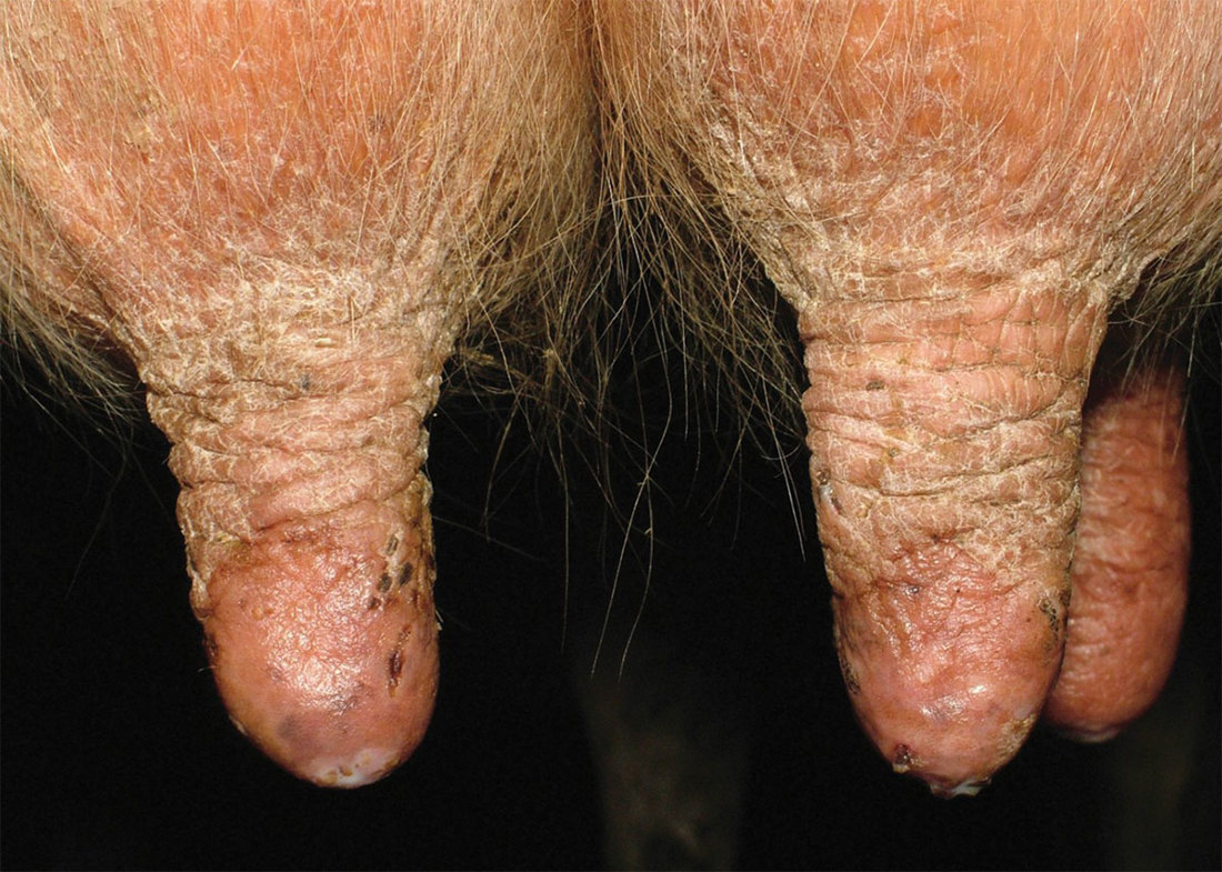 Mastitis Teat Care Unhealthy Teats 1200X856